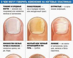 Если трескаются ногти на ногах ли руках: причины, лечение, ремонт